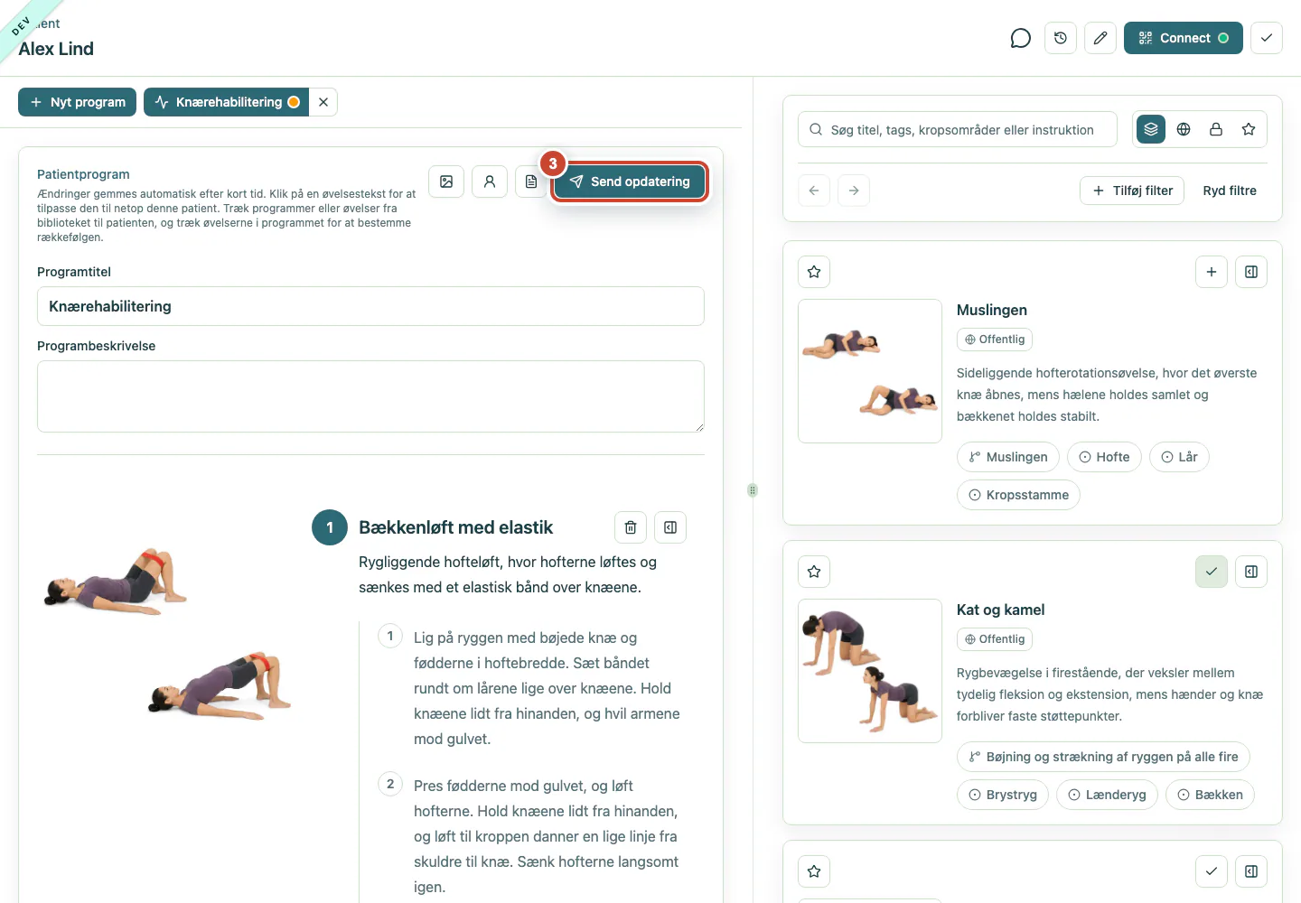Patientprogrammet med knappen Send opdatering markeret.